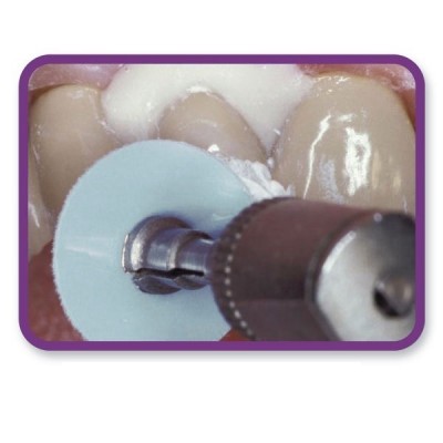 نمد پرداخت کامپوزیت - Cosmedent - FlexiBuff