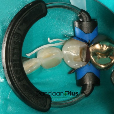 ماتریکس سکشنال - Garrison - SXR