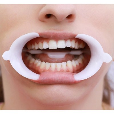 دهان بازکن - FGM - Arcflex