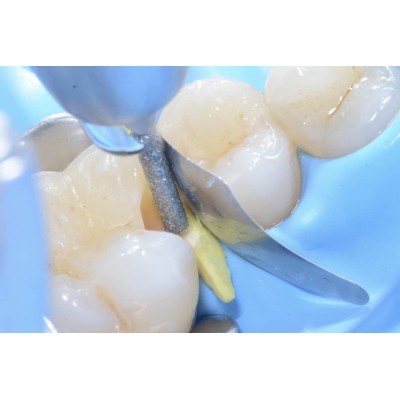 سکشنال ماتریس - Polydentia - PolydentiaPro