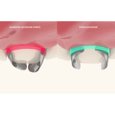 سکشنال ماتریس - Polydentia - Unica Proximal Anterior