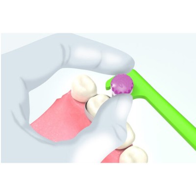 نوار ماتریس مولار و پری‌مولار - Polydentia - Quickmat All-Round