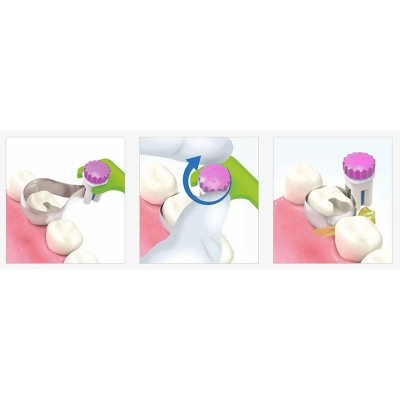 نوار ماتریس مولار و پری‌مولار - Polydentia - Quickmat All-Round