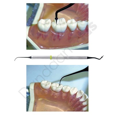 قلم پرداخت کامپوزیت YDM- composite filling instrument