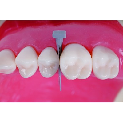 فندروج پرپ - Directa - FenderWedge Prep