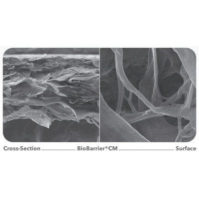ممبرین تاندون آشیل (غشای کلاژنی قابل جذب) NovaTeb - BioBarrier CM