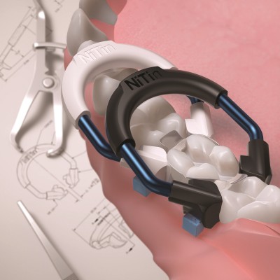 کیت سکشنال ماتریکس - Garrison - Nitinol Sectional Matrix System Kit