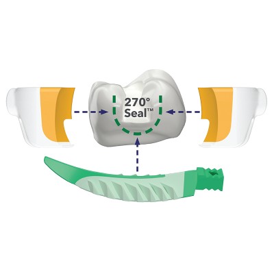 کیت سکشنال ماتریکس - Garrison - Strata-G Sectional Matrix System