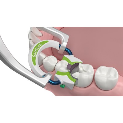 کیت سکشنال ماتریکس - Garrison - Strata-G Sectional Matrix System