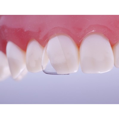 فرم دهنده کامپوزیت - Directa - CoForm