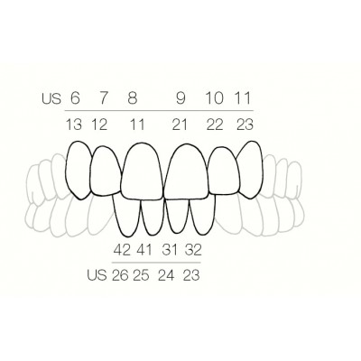 فرم دهنده کامپوزیت - Directa - CoForm