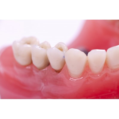 مارکر کانتکت پوینت - Directa - Spotit