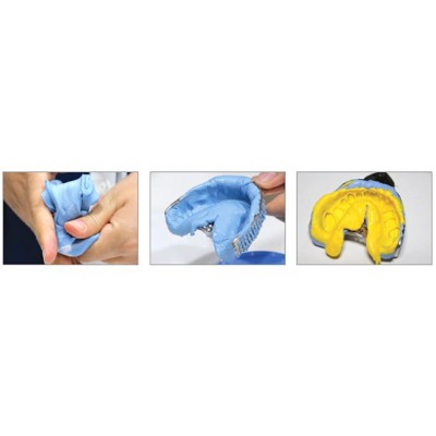 پوتی - Neosil - Peakosil Putty Fast Set