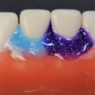 ژل محافظ لثه - Morvabon - Morva Dam