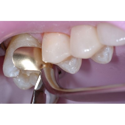 کیت سکشنال ماتریکس طلایی - Garrison - Composi-Tight Gold