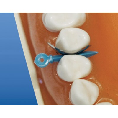 وج شمشیری سایز متوسط - TorVM - Self-Adapting Fixing Wedges