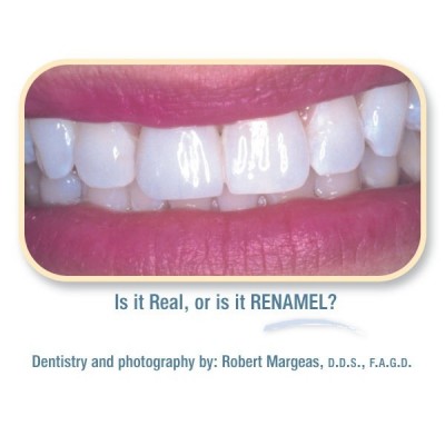 کامپوزیت انامل میکروفیل - Cosmedent - Renamel Microfill