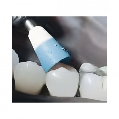 پالیشر الماسه - Kerr - Identoflex Diamond Polisher