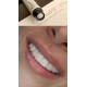 کامپوزیت نانوهیبرید - Dentkist - CharmFil Plus