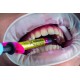 کامپوزیت زیرو فلو - Shofu - Beautifil Injectable X