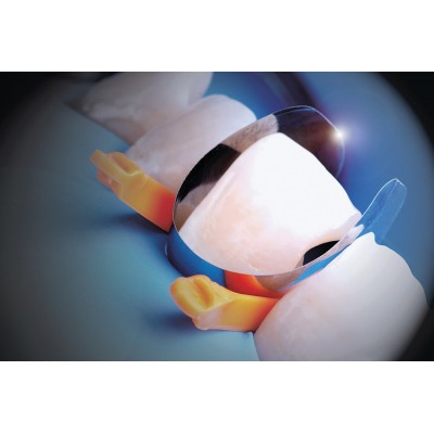 سکشنال ماتریس قدامی - Polydentia - Unica Anterior Matrix