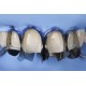 سکشنال ماتریس قدامی - Polydentia - Unica Minideep Anterior Matrix