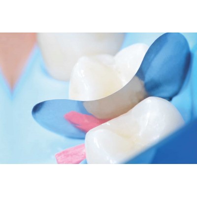 سکشنال ماتریس منعطف - Polydentia - Flex Sectional Matrices