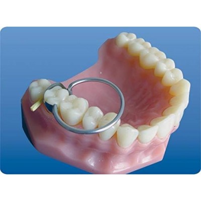 کیت نوار ماتریس سدل - TorVM - Saddle Metal Matrices