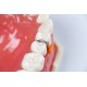 فندروج تک سایز ۱۰۰عددی - Directa - Fender Wedge