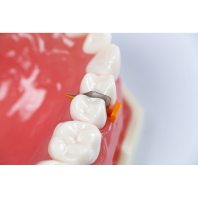 فندروج تک سایز ۱۰۰عددی - Directa - Fender Wedge
