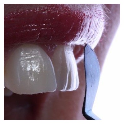 قلم کامپوزیت - Cosmedent - CASI 3C