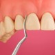 قلم کامپوزیت - Cosmedent - CASI 3C