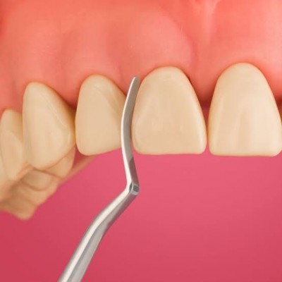 قلم کامپوزیت - Cosmedent - CASI 3C