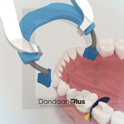 رینگ Polydentia- MyRingClassico