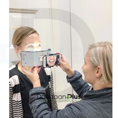 وسیله عکاسی Smile Line- Smile Lite MDP