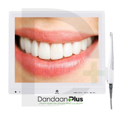 دوربین داخل دهانی - SCS - Intraoral Camera