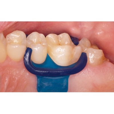 سیلیکون دم - DMG - MiniDam