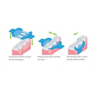 سیلیکون دم - DMG - MiniDam