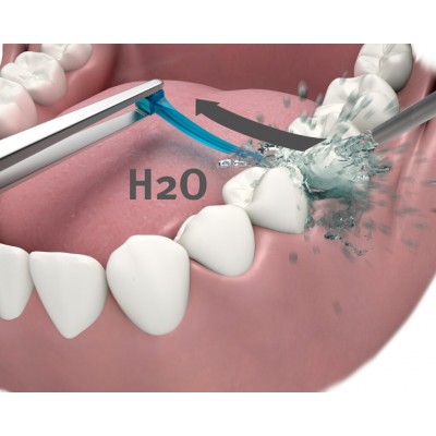 کیت وج بندآورنده خون - Garrison - A+ Wedge